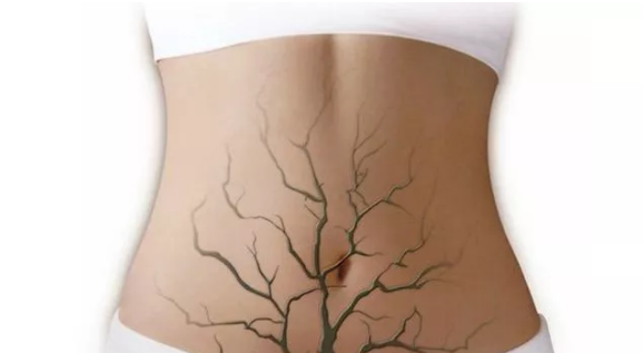 試管嬰兒前需要結扎輸卵管嗎 結扎對試管嬰兒卵泡數量有影響嗎