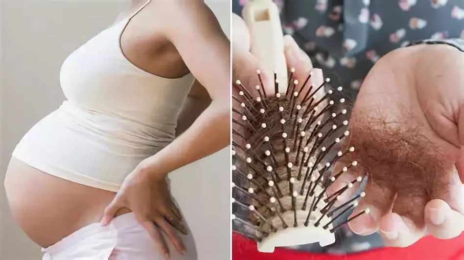 生完孩子多久后會掉頭發(fā) 生完孩子掉頭發(fā)的原因有哪些