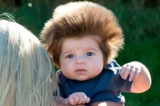 寶寶頭發又細又黃是遺傳原因嗎 寶寶頭發又細又黃吃什么好 寶寶頭發又細又黃是遺傳原因嗎 寶寶頭發又細又黃吃什么好