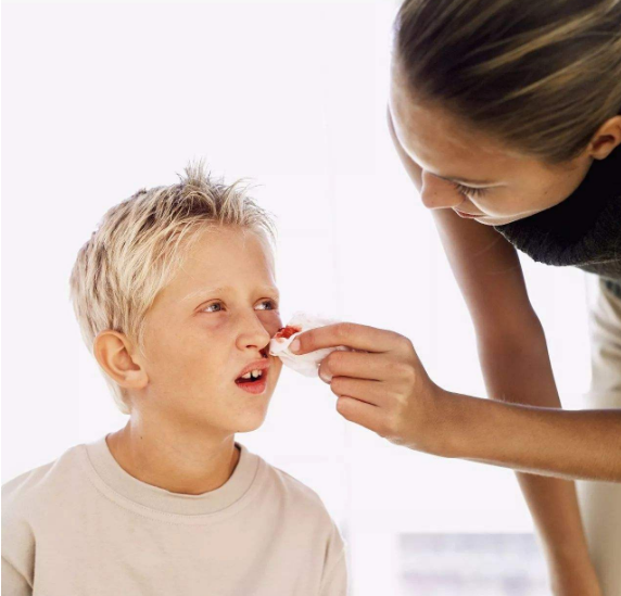 孩子流鼻血怎么做比較好 孩子流鼻血正確處理方法