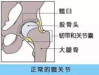 髖關節發育怎么排查有沒有問題 孩子髖關節發育問題檢查