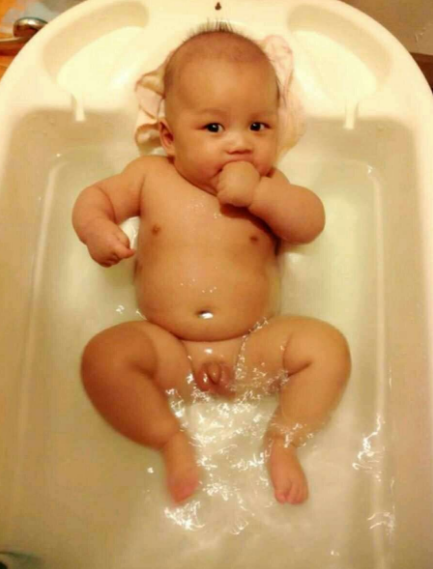 孩子牛奶過敏能吃蛋黃嗎 孩子牛奶過敏藥注意什么