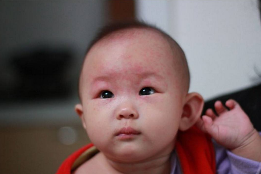 嬰兒吃藥跟體重有什么關系 嬰兒發燒吃多少藥好