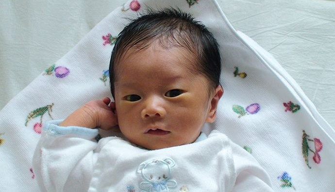 懷孕的時(shí)候要注意什么生出來的孩子不會(huì)黃疸 如何避免黃疸和胎毒 懷孕的時(shí)候要注意什么生出來的孩子不會(huì)黃疸 如何避免黃疸和胎毒