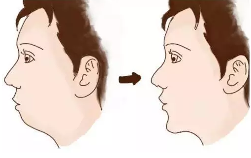 小七短發(fā)撞臉?gòu)寢?孩子是更像父親還是更像母親