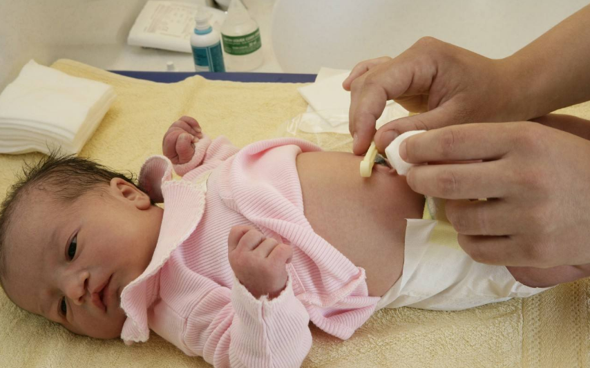 寶寶的臍帶怎么護理好 孩子的臍帶什么時候會自然脫落