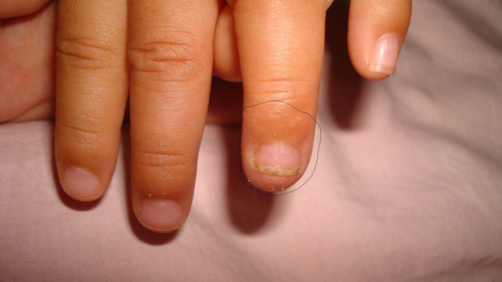 新生寶寶的指甲怎么護(hù)理 新生兒寶寶指甲的清潔護(hù)理方法