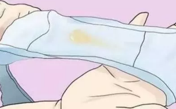 懷孕分泌物多生男生女2018 為什么懷孕后陰道分泌物增多了