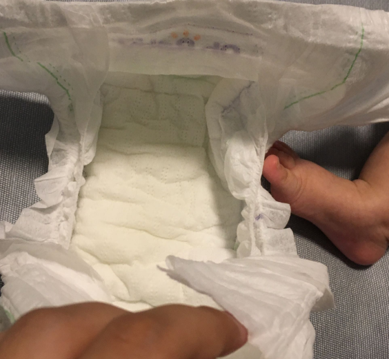 歐貝比嬰兒紙尿褲會(huì)紅屁股嗎 歐貝比嬰兒紙尿褲使用測(cè)評(píng) 歐貝比嬰兒紙尿褲會(huì)紅屁股嗎 歐貝比嬰兒紙尿褲使用測(cè)評(píng)