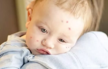 秋季如何讓給寶寶防蚊 秋季防蚊的重要性 秋季如何讓給寶寶防蚊 秋季防蚊的重要性