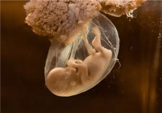 羊水偏多是為什么 羊水偏多會對寶寶造成什么影響