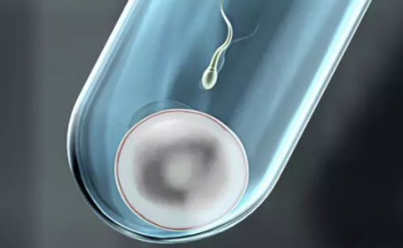 為什么很多人去泰國做試管嬰兒 泰國試管嬰兒有什么優(yōu)勢