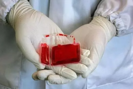 臍帶血有什么用 保存臍帶血有必要嗎