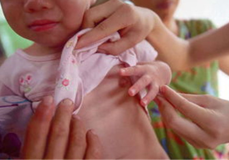 孩子吃什么容易性早熟 孩子性早熟有什么表現