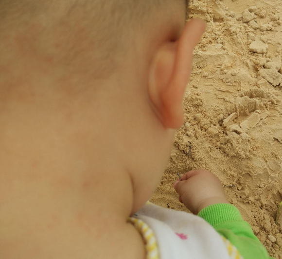 貝親桃子水會過敏嗎 日本貝親桃子水使用方法