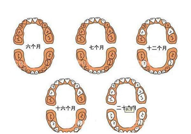 孩子出牙晚正常嗎 孩子出牙晚需要補鈣嗎 孩子出牙晚正常嗎 孩子出牙晚需要補鈣嗎