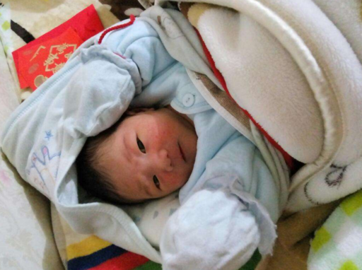 孩子秋季濕疹如何避免 如何幫寶寶對付秋季濕疹