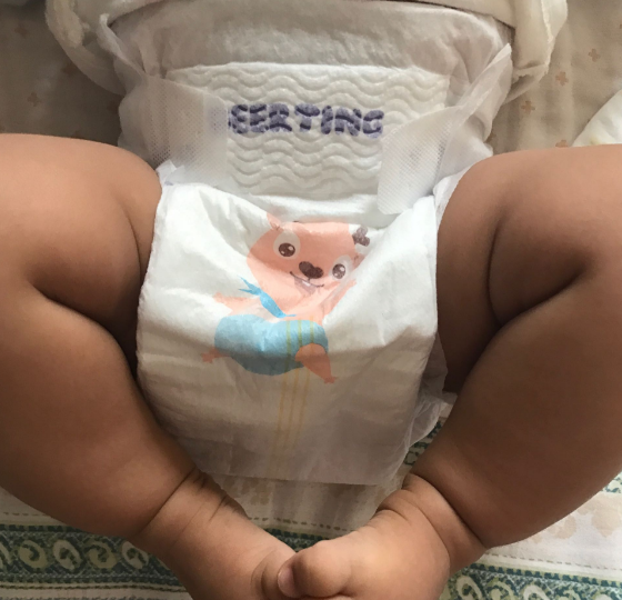 小鹿叮叮超薄紙尿褲好用嗎 小鹿叮叮超薄紙尿褲使用測(cè)評(píng) 小鹿叮叮超薄紙尿褲好用嗎 小鹿叮叮超薄紙尿褲使用測(cè)評(píng)