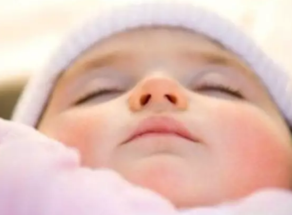 治孩子臉凍小妙招 治孩子臉凍傷了食療方法