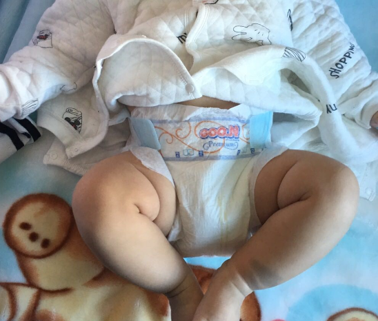 大王天使紙尿褲起坨嗎 日本大王天使紙尿褲怎么樣