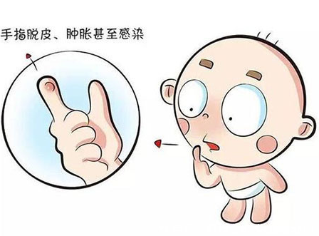 寶寶為什么愛吃手手 如何戒掉吃手手 寶寶為什么愛吃手手 如何戒掉吃手手