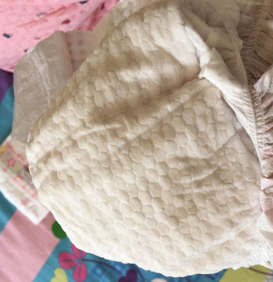 蒙愛海泥紙尿褲起坨嗎 蒙愛海泥紙尿褲有斷層出現(xiàn)嗎 蒙愛海泥紙尿褲起坨嗎 蒙愛海泥紙尿褲有斷層出現(xiàn)嗎