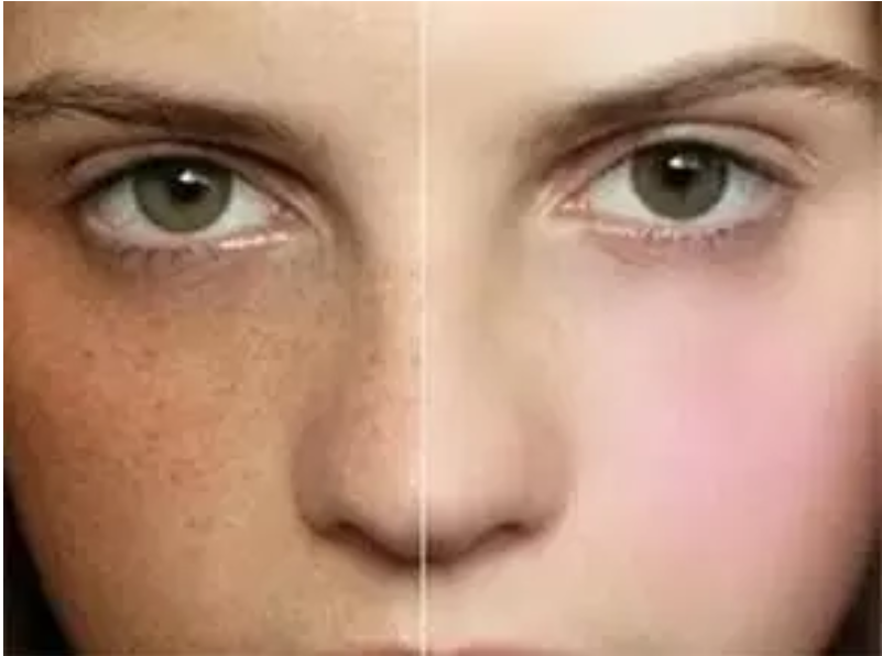 孕期長斑怎么辦 如何防止孕期長斑 孕期長斑怎么辦 如何防止孕期長斑