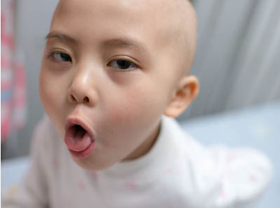 兒童白血病病率持續走高 白血病誘因是什么 兒童白血病病率持續走高 白血病誘因是什么