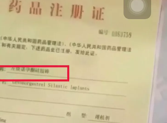 什么是埋線避孕 埋線避孕有什么副作用