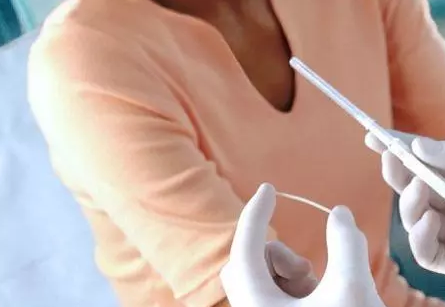 哪些人適合做埋線避孕 哪些人不適合做皮下埋線避孕 哪些人適合做埋線避孕 哪些人不適合做皮下埋線避孕