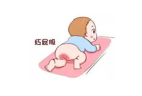 寶寶肛門長小肉粒是怎么回事 寶寶肛門出現紅腫怎么了