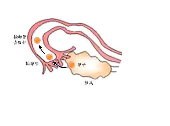 宮角妊娠為什么出血 宮角妊娠有什么癥狀