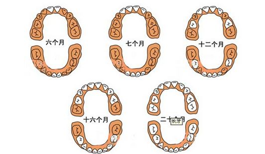 寶寶長牙發(fā)燒怎么辦   長牙發(fā)燒護(hù)理辦法