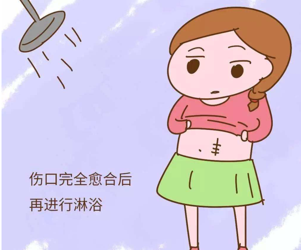 剖腹產(chǎn)后多久可以淋浴 剖腹產(chǎn)淋浴注意事項