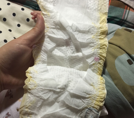 貝+愛紙尿褲會過敏嗎 貝+愛紙尿褲會紅屁股嗎