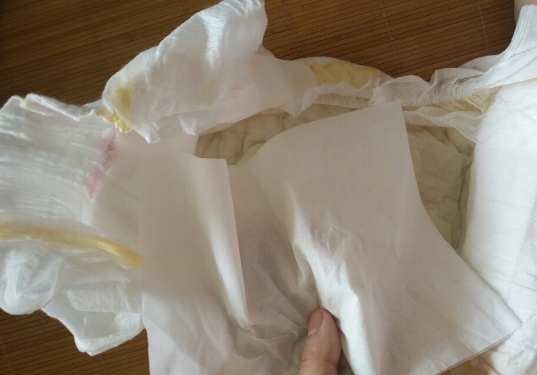 嬰舒寶金鉆紙尿褲會紅屁股嗎 嬰舒寶金鉆紙尿褲使用測評 嬰舒寶金鉆紙尿褲會紅屁股嗎 嬰舒寶金鉆紙尿褲使用測評