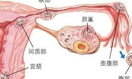 受精卵著床有什么癥狀 受精卵著床的表現一覽 受精卵著床有什么癥狀 受精卵著床的表現一覽
