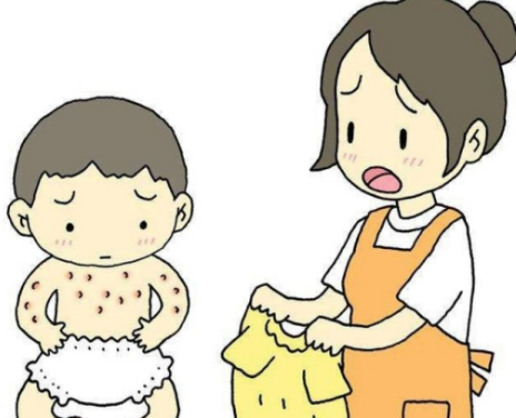 寶寶奶癬怎么治療     寶寶奶癬治療方法