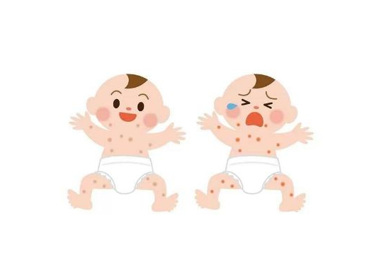 幼兒急疹可以吹風嗎 幼兒急疹怎么重點護理