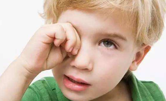 寶寶淚囊炎怎么預(yù)防 新生兒預(yù)防淚囊炎方法 寶寶淚囊炎怎么預(yù)防 新生兒預(yù)防淚囊炎方法