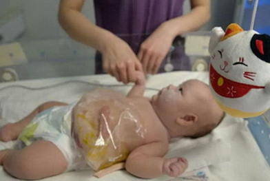 新生兒敗血癥的并發(fā)癥有哪些  敗血癥最常見的并發(fā)癥介紹