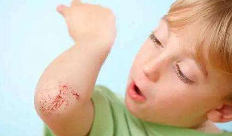 寶寶摔傷怎么處理    寶寶摔傷急救處理方法