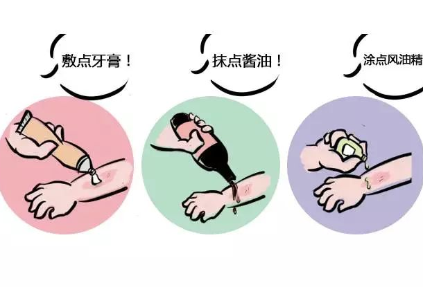 寶寶燙傷冷療冷敷方法    燙傷護理方法介紹