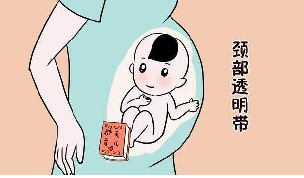 NT檢查是什么 NT檢查的最佳時間是什么時候