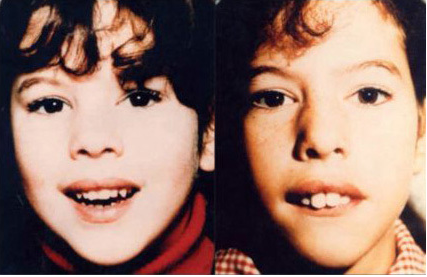 腺樣體肥大什么程度做手術 腺樣體肥大對孩子的影響