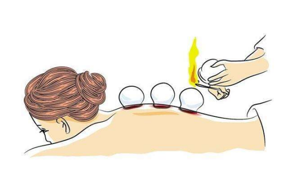 備孕宮寒怎么怎么調理 備孕宮寒調理方法 備孕宮寒怎么怎么調理 備孕宮寒調理方法