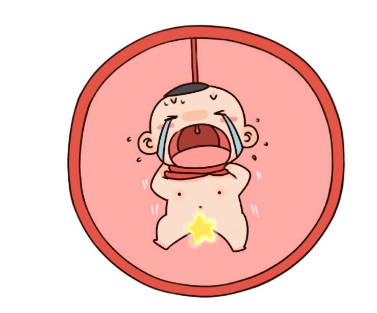 臍帶繞頸能順產嗎 臍帶繞頸兩周可以脫開嗎 臍帶繞頸能順產嗎 臍帶繞頸兩周可以脫開嗎