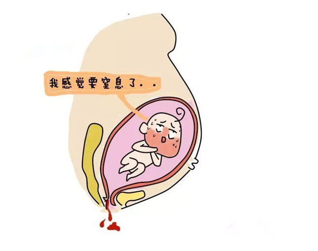 什么是高位破水 高位破水如何自測(cè)