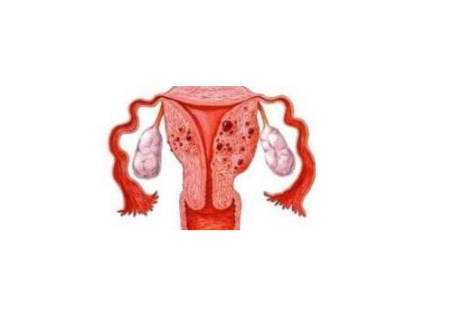 卵巢腫瘤還能懷孕嗎 卵巢囊腫可以同房嗎