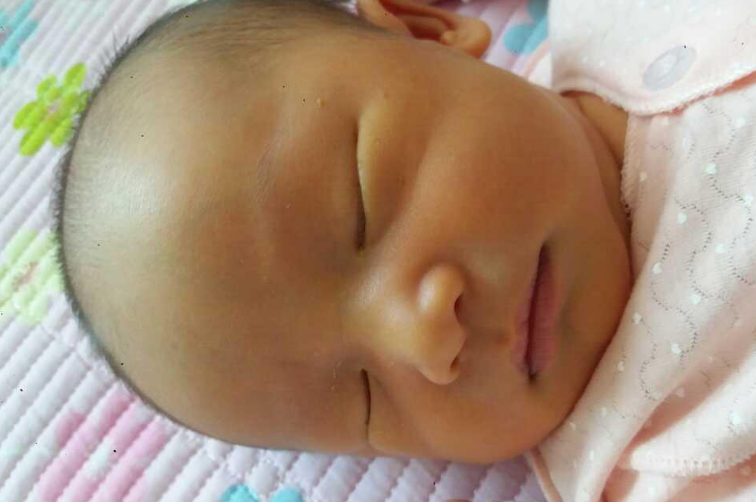 孩子上火了怎么處理比較好 孩子上火癥狀正確處理方法